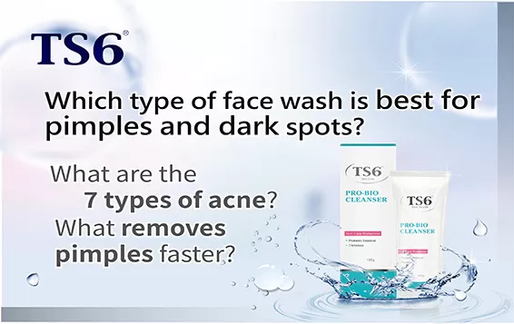 Which type of face wash is best for pimples and dark spots? What are the 7 types of acne? What removes pimples faster?